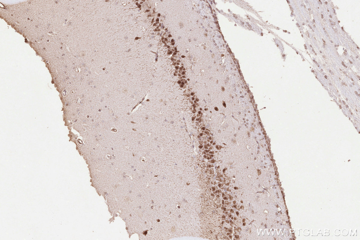 IHC staining of rat brain using 14520-1-AP IHC staining of rat brain using 14520-1-AP