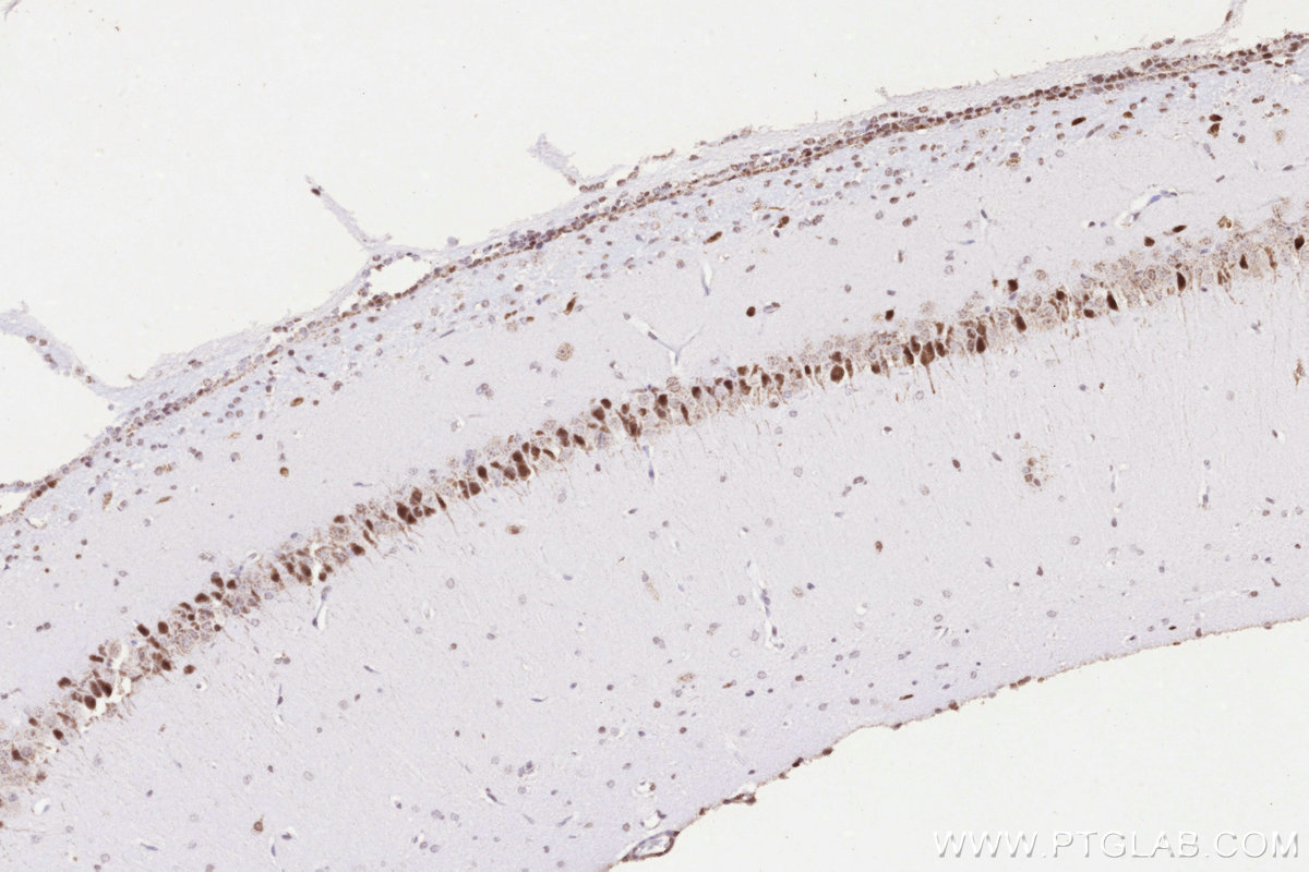 IHC staining of rat brain using 14520-1-AP IHC staining of rat brain using 14520-1-AP