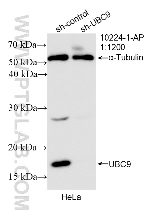 WB analysis of HeLa using 10224-1-AP WB analysis of HeLa using 10224-1-AP