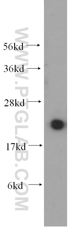 WB analysis of mouse spleen using 10224-1-AP