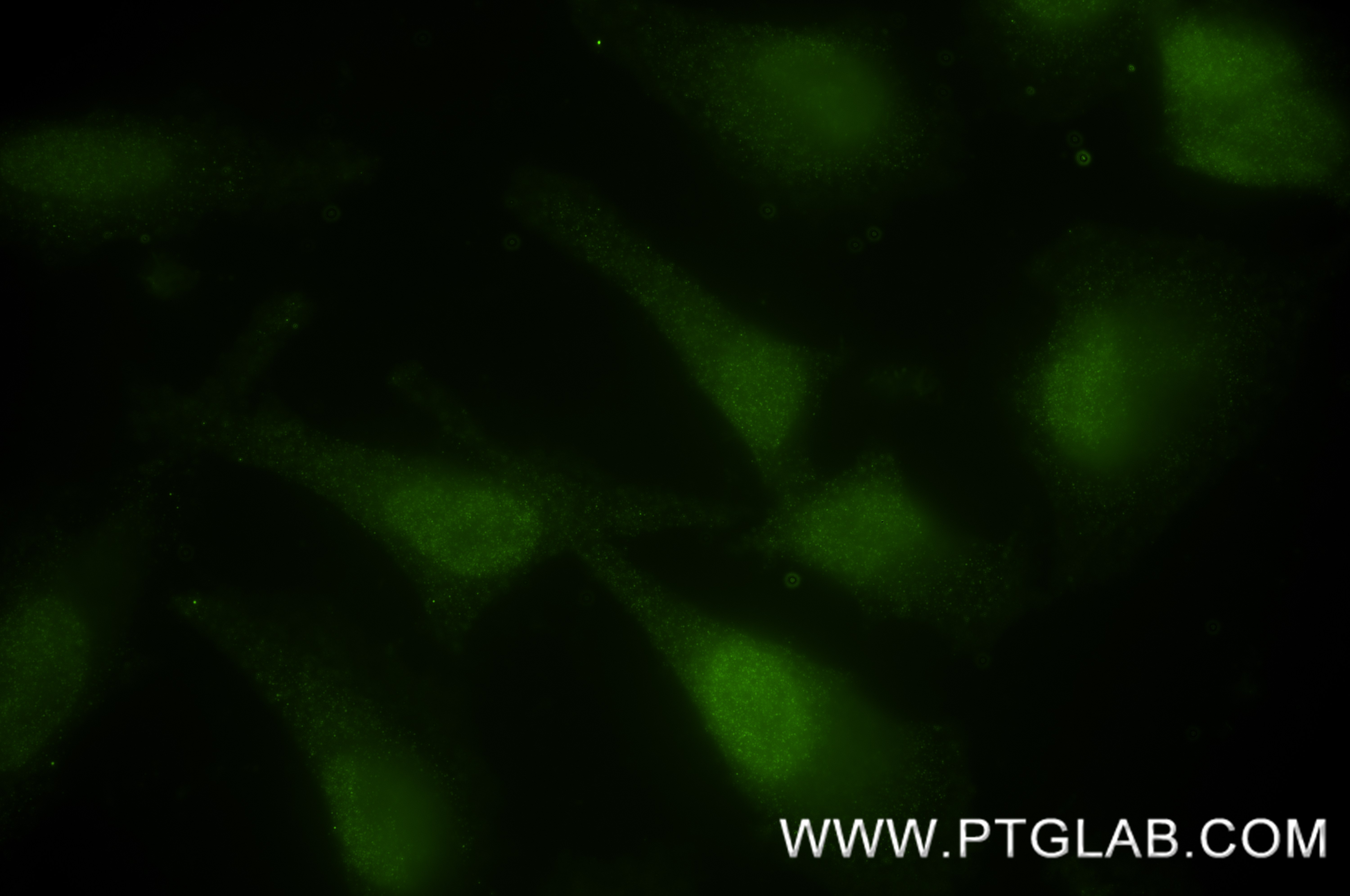 IF Staining of HeLa using 87319-1-RR IF Staining of HeLa using 87319-1-RR