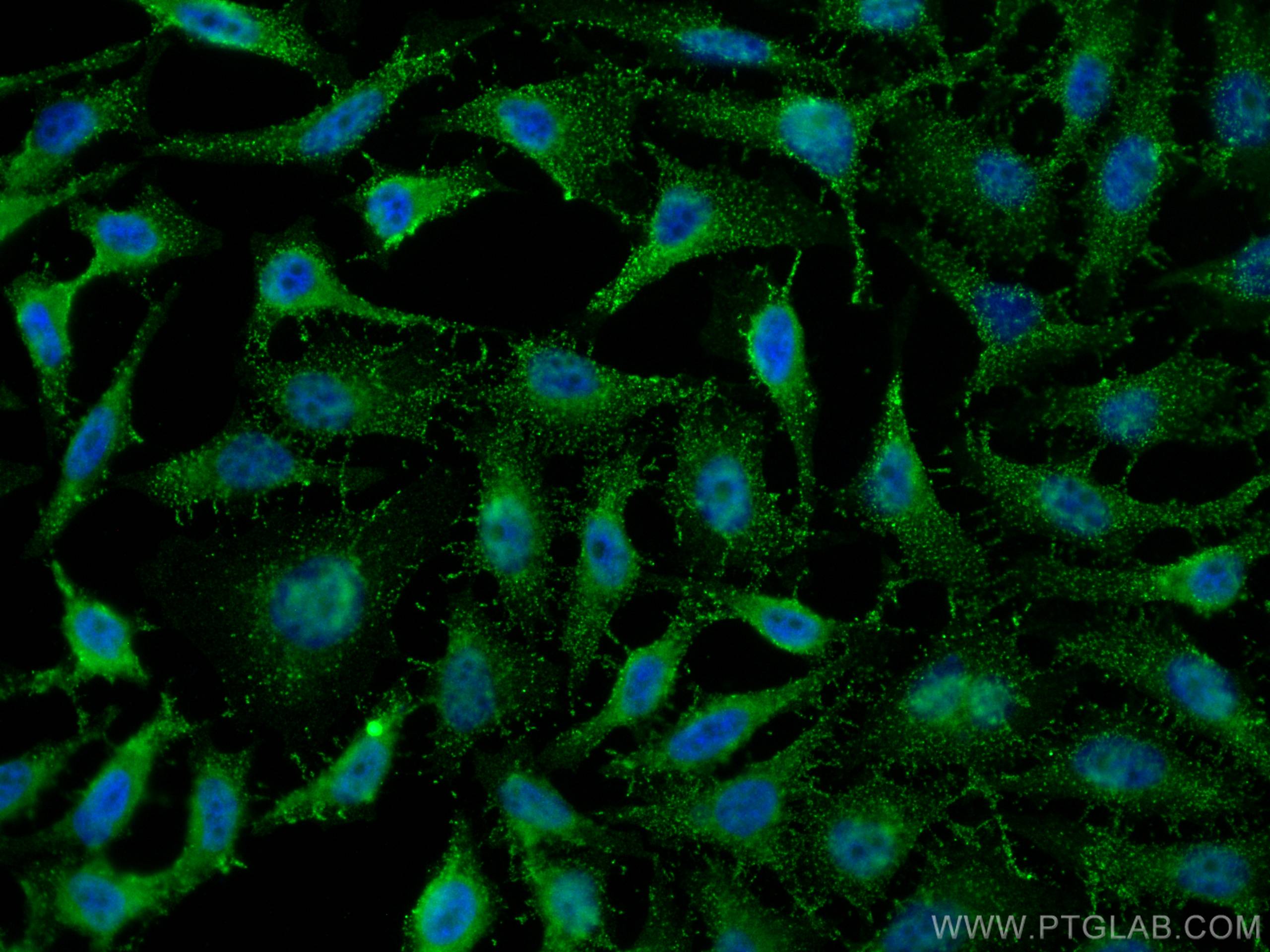 IF Staining of HeLa using 67198-1-Ig (same clone as 67198-1-PBS)