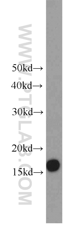 WB analysis of HEK-293 using 11080-1-AP