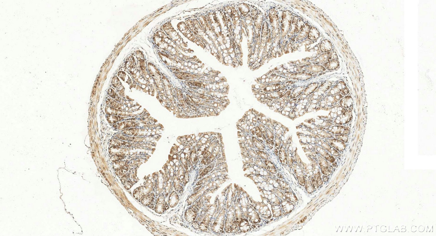 IHC staining of mouse colon using 12134-2-AP IHC staining of mouse colon using 12134-2-AP