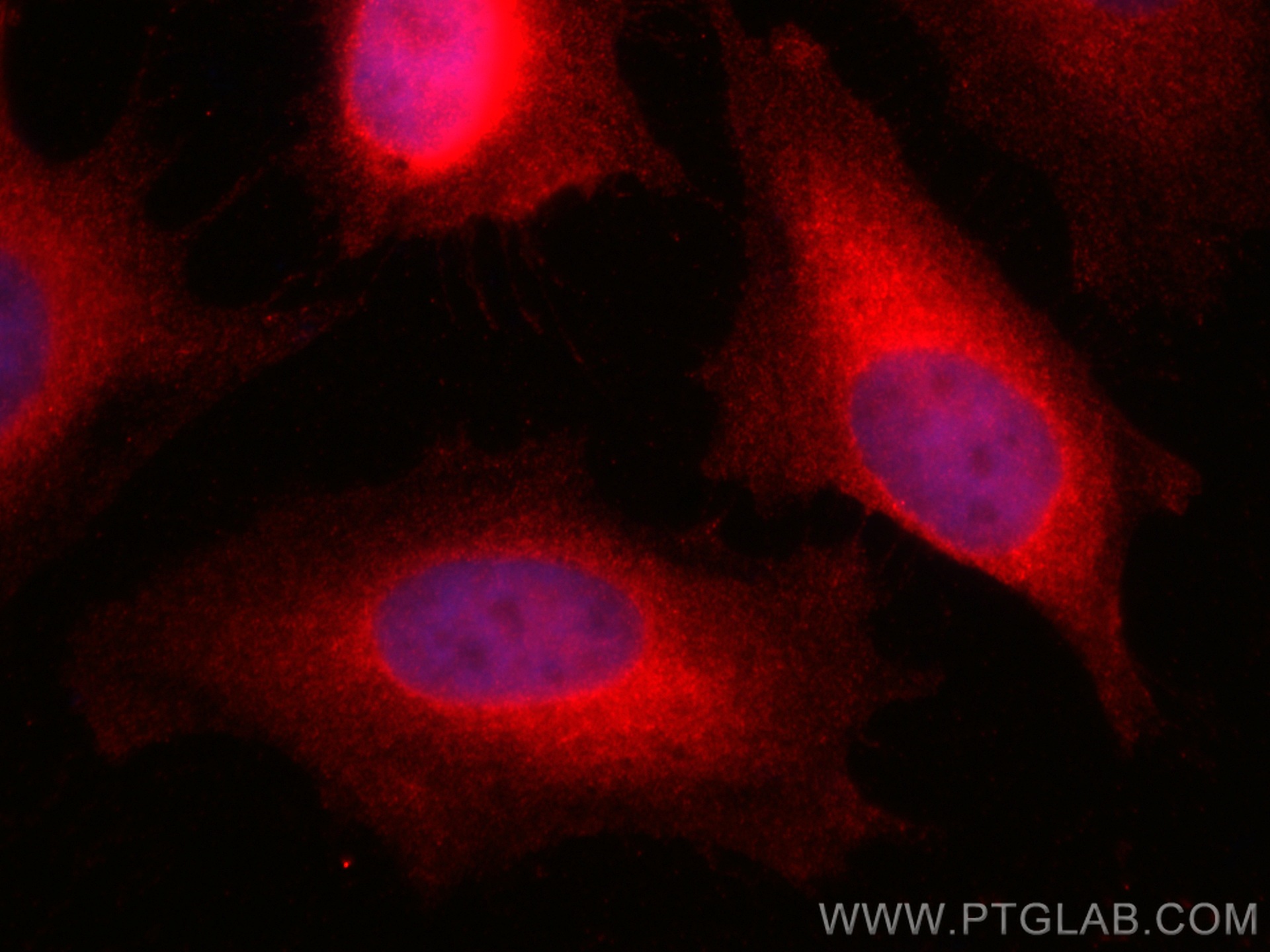 IF Staining of HeLa using CL594-66087