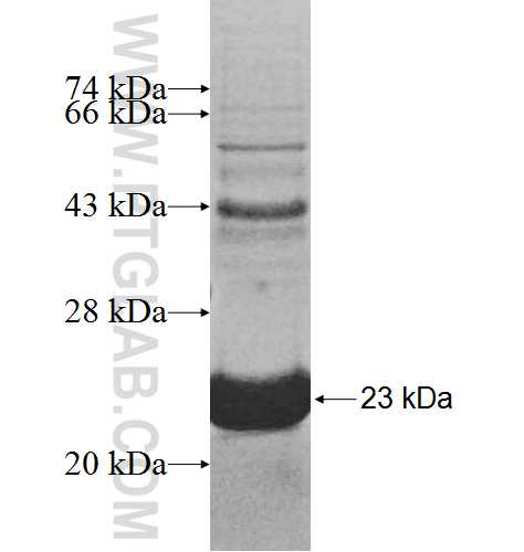 UBE2D4 fusion protein Ag7627 SDS-PAGE UBE2D4 fusion protein Ag7627 SDS-PAGE
