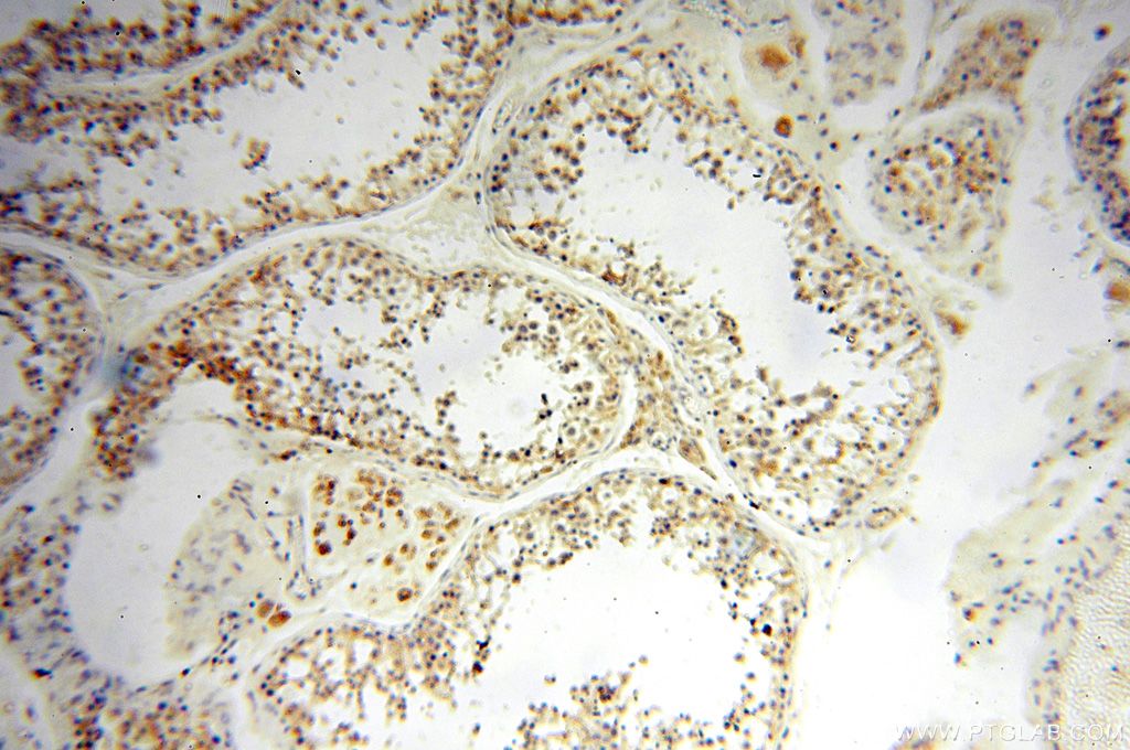 IHC staining of human testis using 17287-1-AP