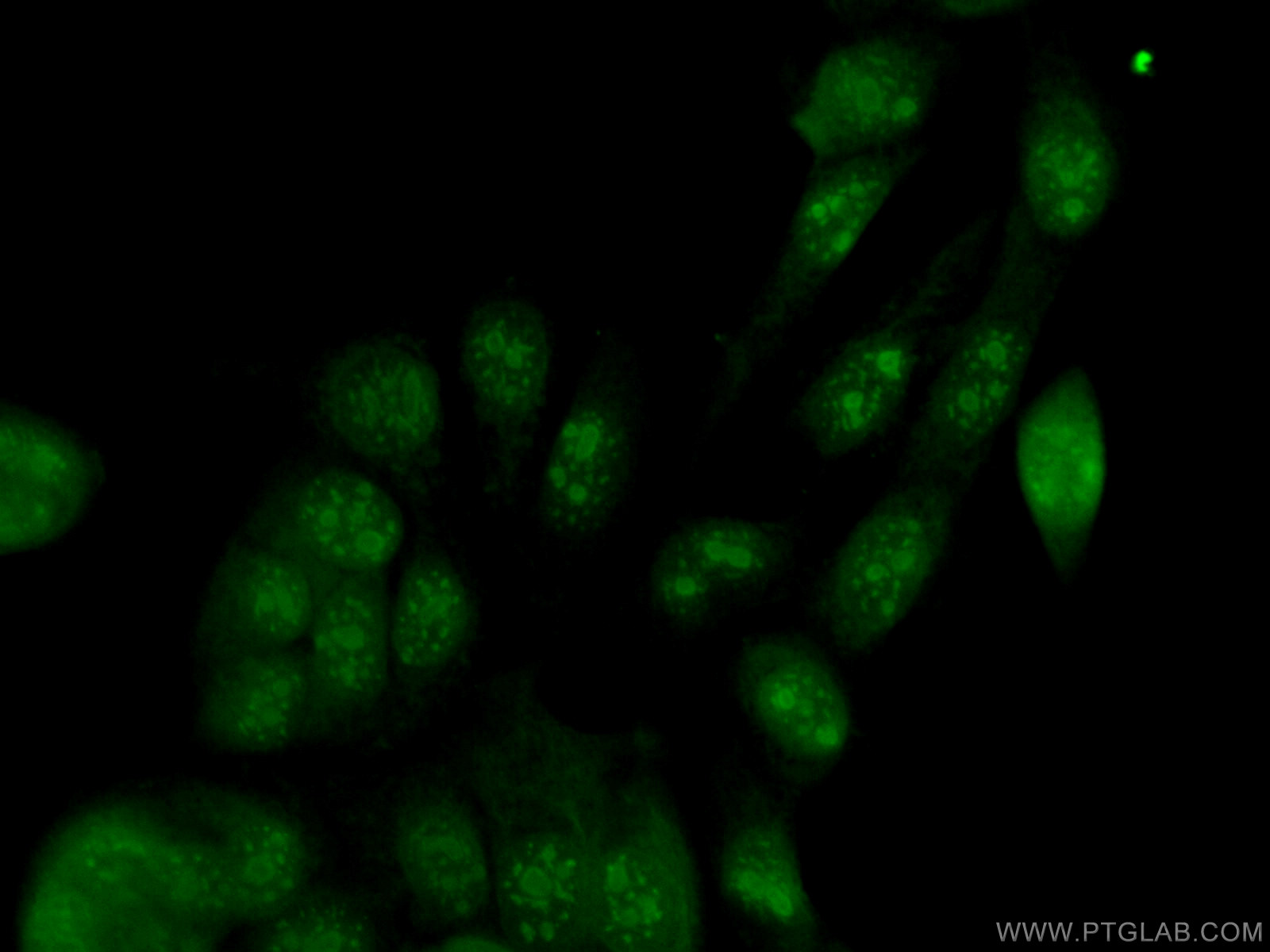 IF Staining of MCF-7 using 55457-1-AP