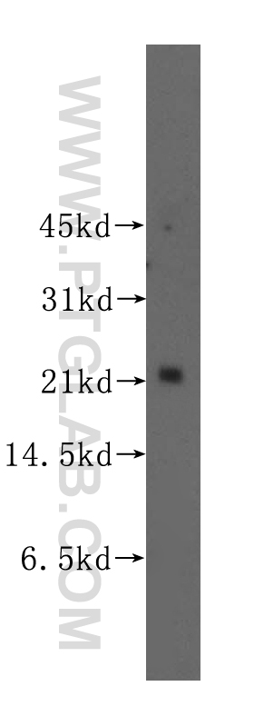 WB analysis of human thyroid gland using 11844-1-AP