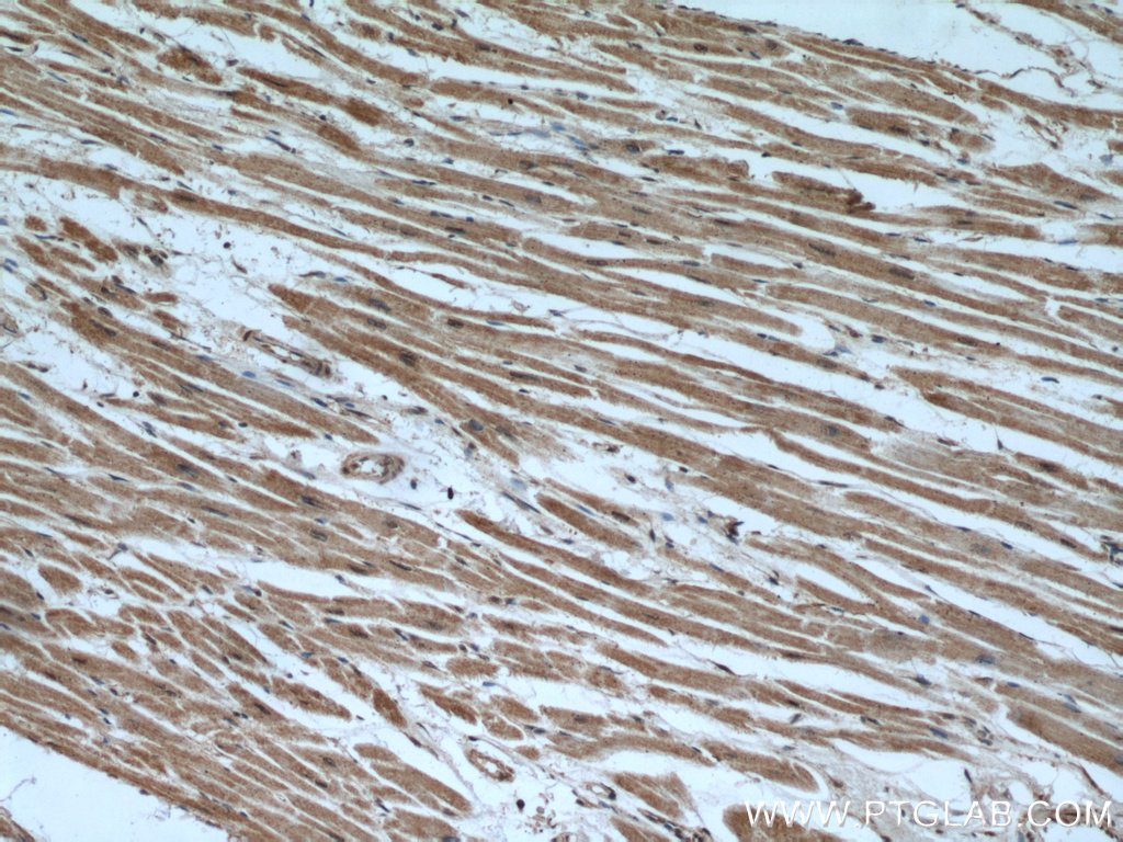 IHC staining of human heart using 15488-1-AP