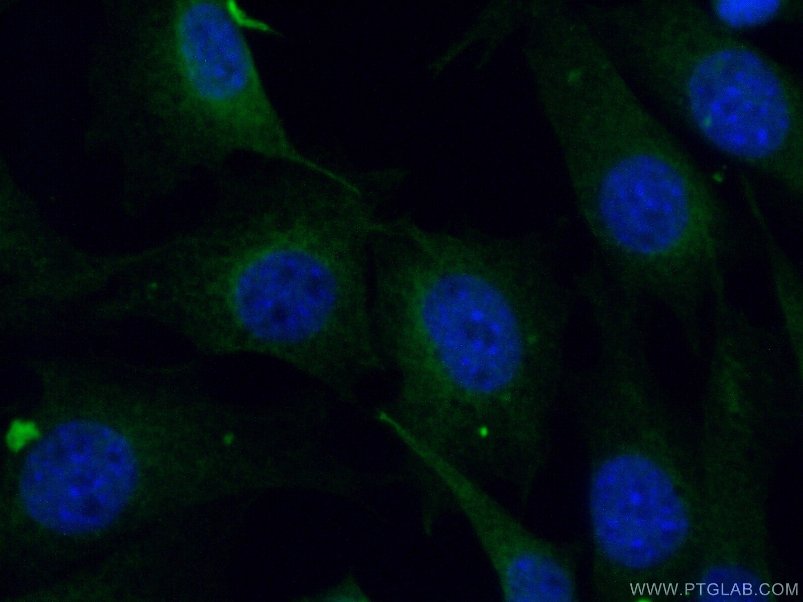 IF Staining of NIH/3T3 using 17056-1-AP