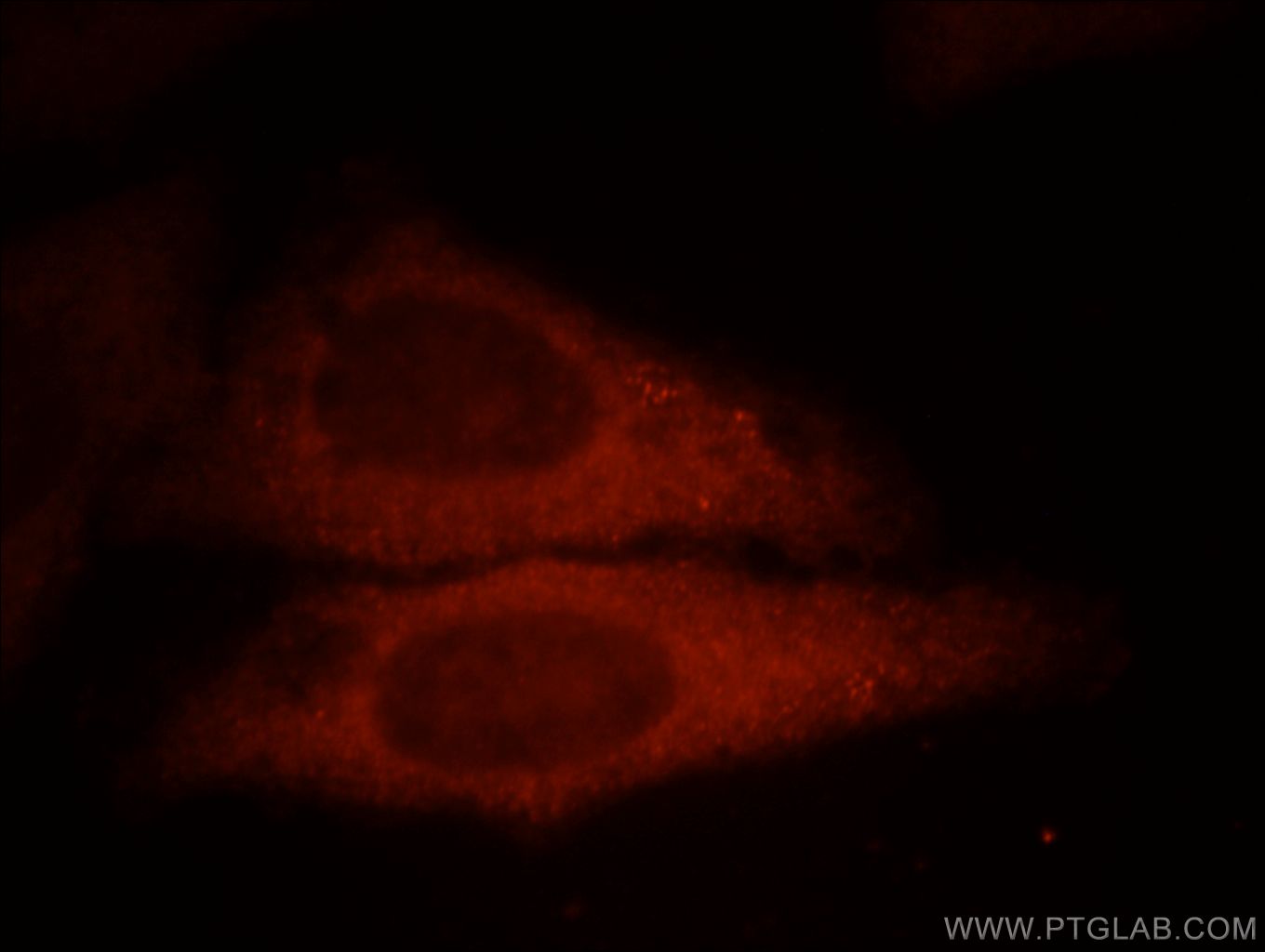 IF Staining of HepG2 using 12012-1-AP