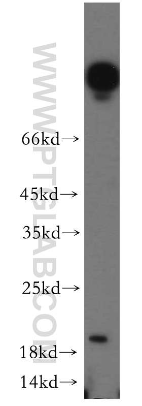 WB analysis of HeLa using 12012-1-AP