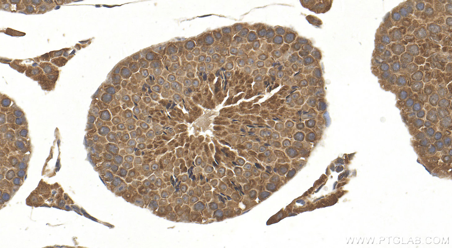 IHC staining of mouse testis using 10722-1-AP