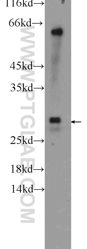 WB analysis of mouse liver using 17713-1-AP