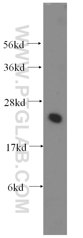 UBE2K Polyclonal antibody