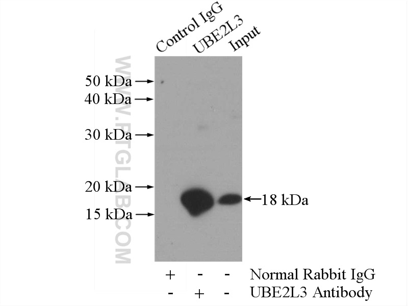 IP experiment of mouse kidney using 14415-1-AP (same clone as 14415-1-PBS)