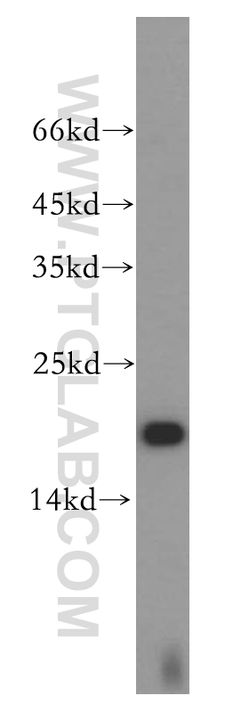 WB analysis of HeLa using 14415-1-AP (same clone as 14415-1-PBS)