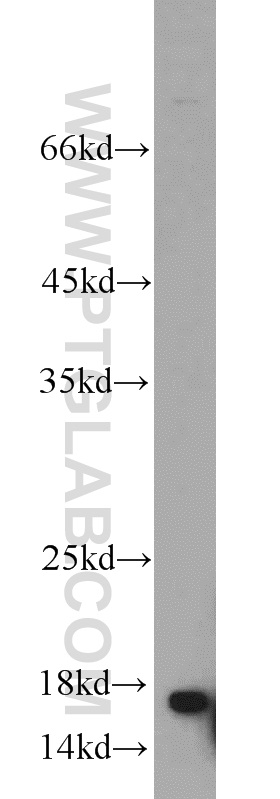 WB analysis of mouse thymus using 10243-1-AP