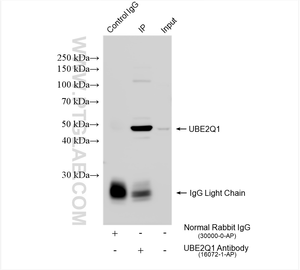 IP experiment of HEK-293 using 16072-1-AP
