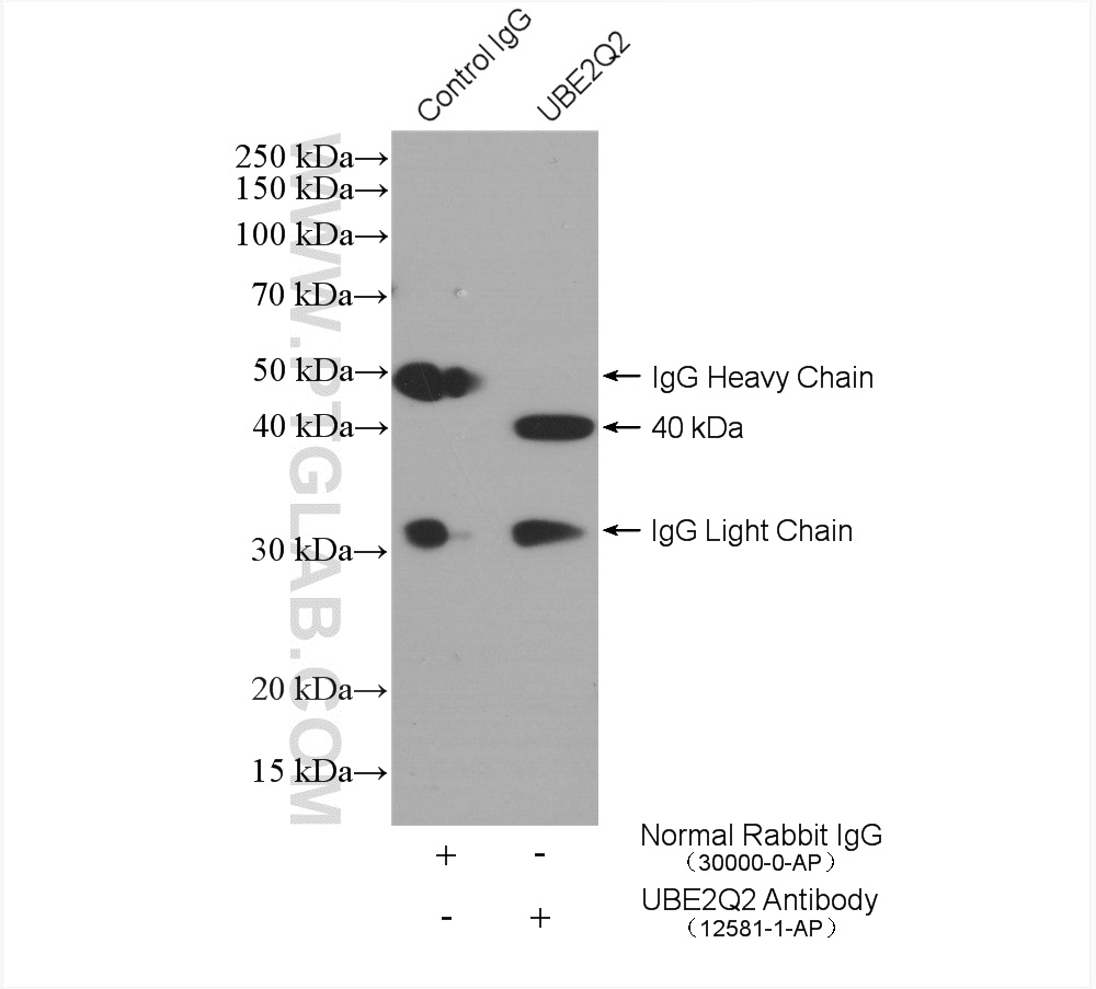 IP experiment of HEK-293T using 12581-1-AP