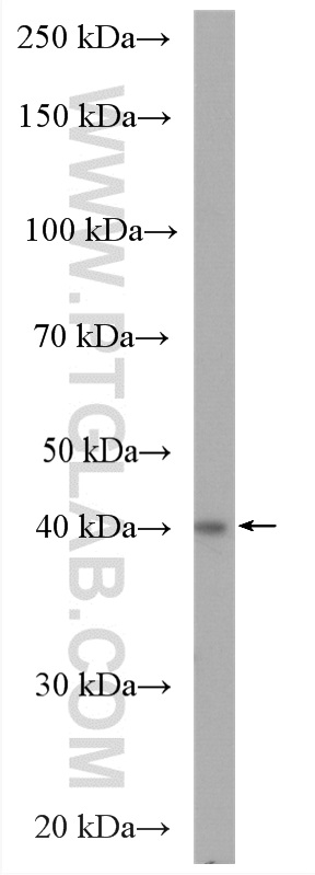 WB analysis of HEK-293T using 12581-1-AP