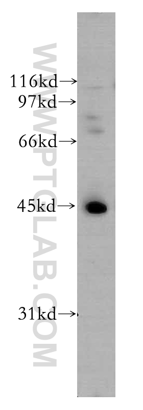 WB analysis of A431 using 12581-1-AP