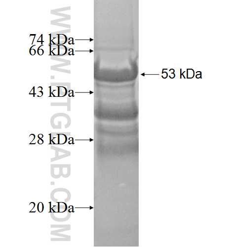 UBE2R2 fusion protein Ag5202 SDS-PAGE
