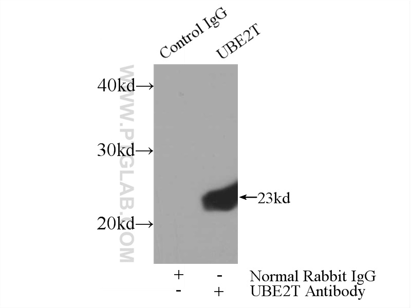 IP experiment of HeLa using 10105-2-AP