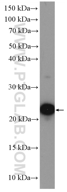 WB analysis of HeLa using 10105-2-AP