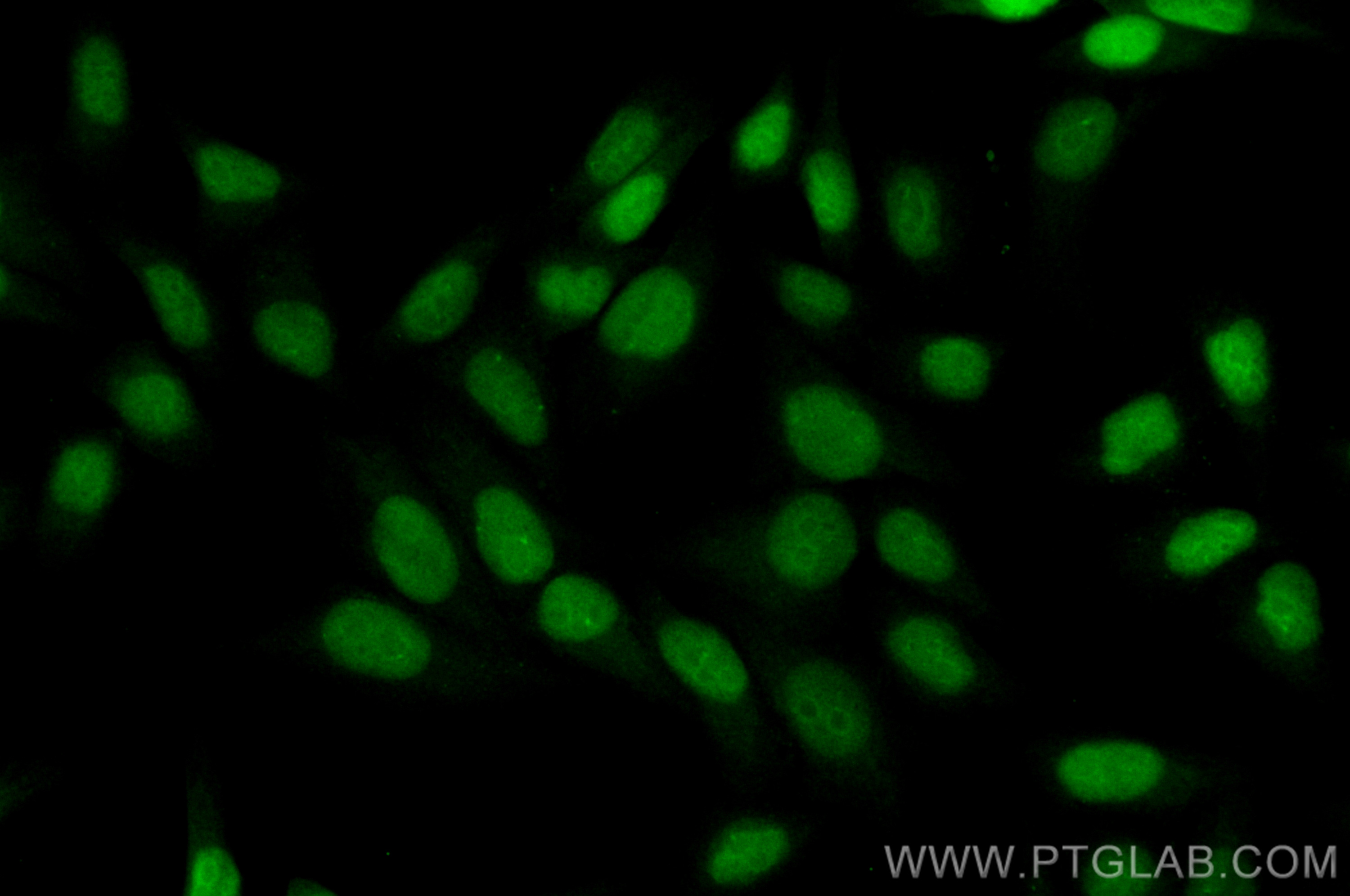 IF Staining of HepG2 using CL488-10105