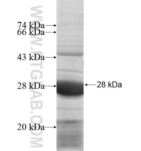 UBE2U fusion protein Ag11333 SDS-PAGE UBE2U fusion protein Ag11333 SDS-PAGE