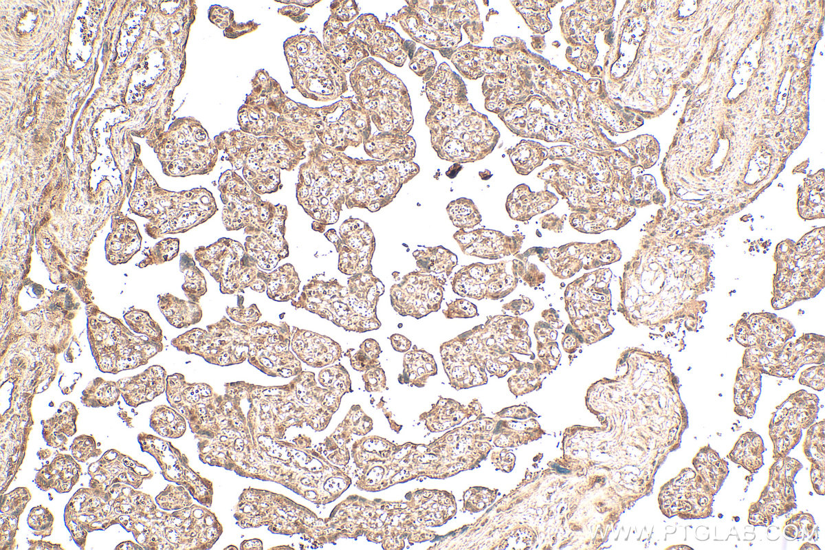 Immunohistochemical analysis of paraffin-embedded human placenta tissue slide using 16928-1-AP (UBE2Z antibody) at dilution of 1:200 (under 10x lens). Heat mediated antigen retrieval with Tris-EDTA buffer (pH 9.0). IHC staining of human placenta using 16928-1-AP