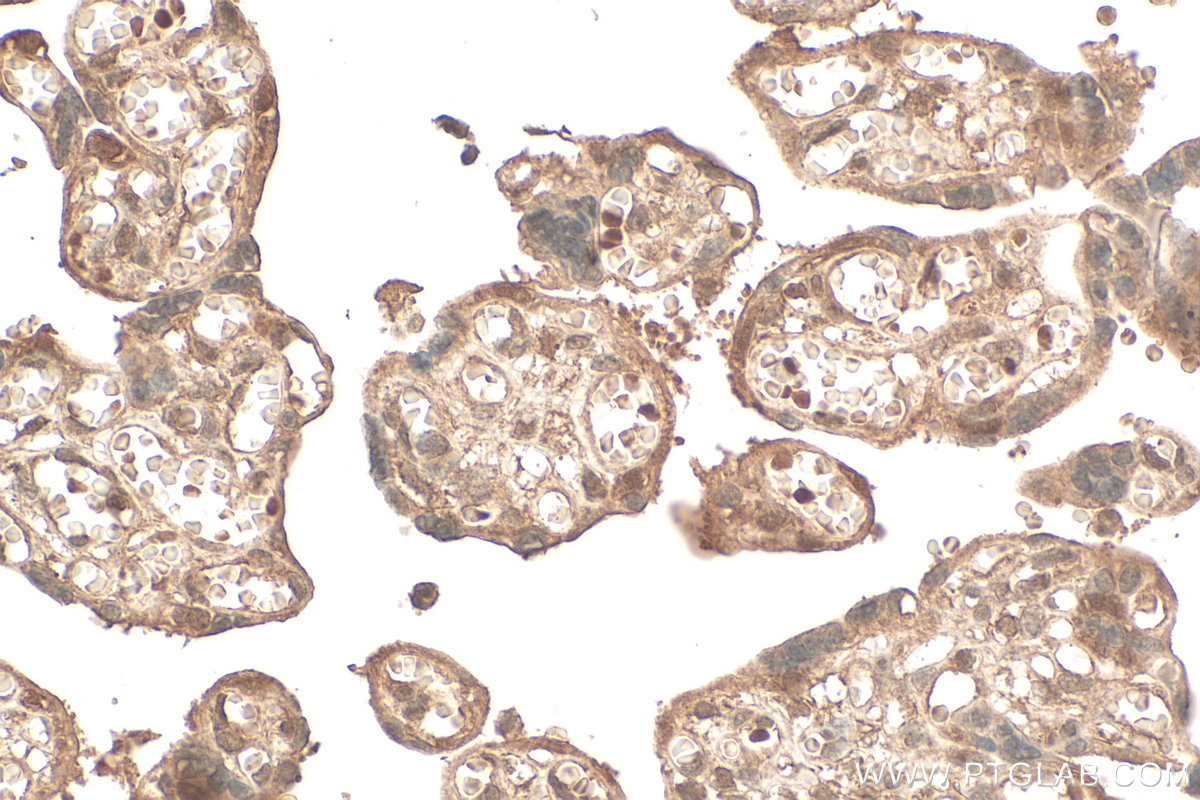 Immunohistochemical analysis of paraffin-embedded human placenta tissue slide using 16928-1-AP (UBE2Z antibody) at dilution of 1:200 (under 40x lens). Heat mediated antigen retrieval with Tris-EDTA buffer (pH 9.0). IHC staining of human placenta using 16928-1-AP