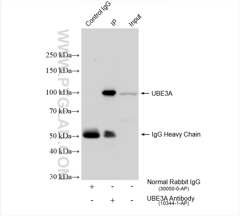 IP experiment of K-562 using 10344-1-AP