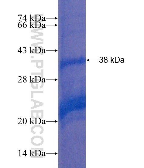 UBE3B fusion protein Ag21405 SDS-PAGE