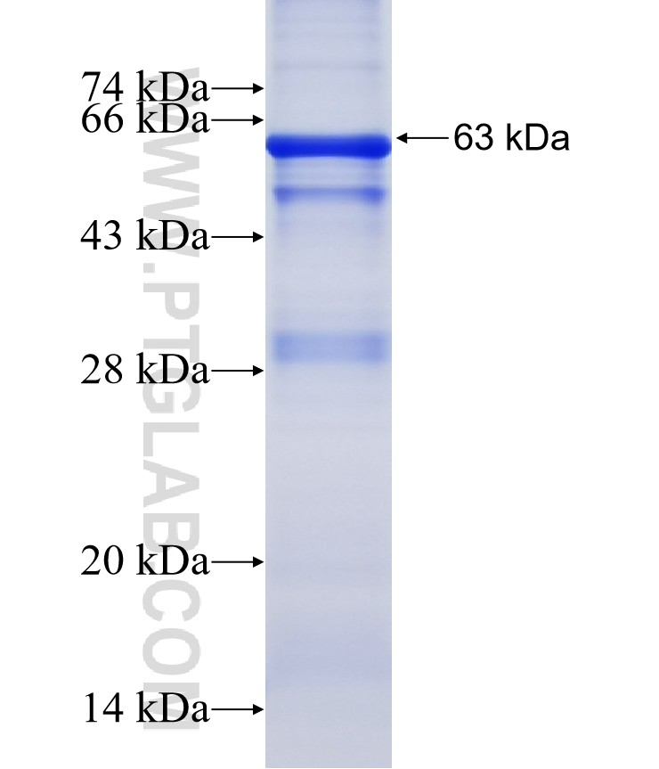 UBE3C fusion protein Ag2966 SDS-PAGE