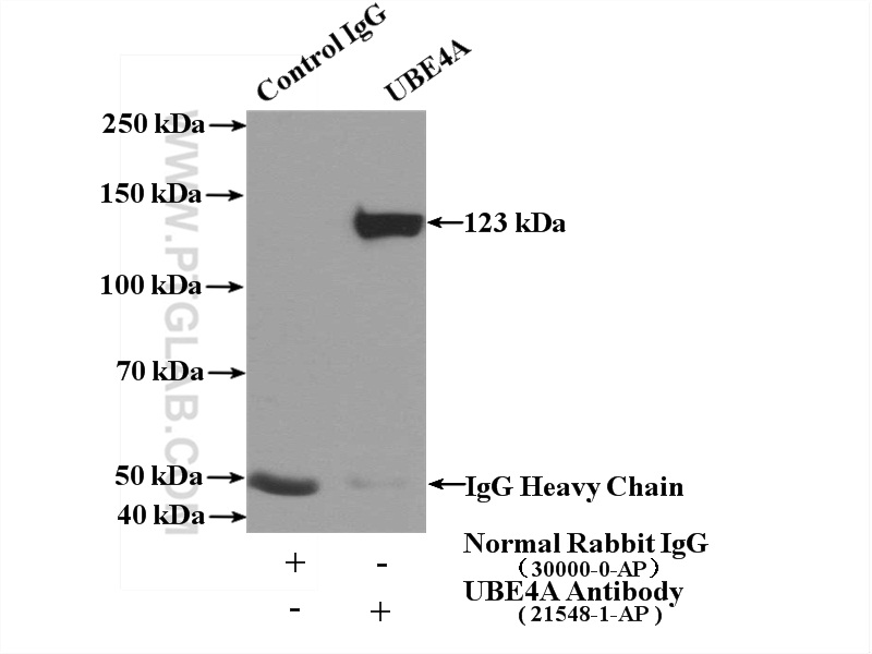 IP experiment of mouse brain using 21548-1-AP