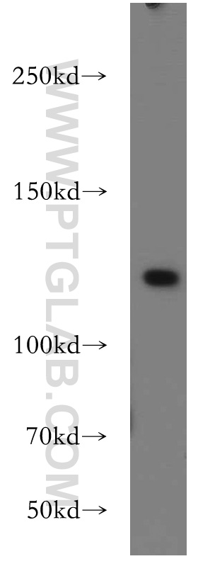 WB analysis of HEK-293 using 21548-1-AP