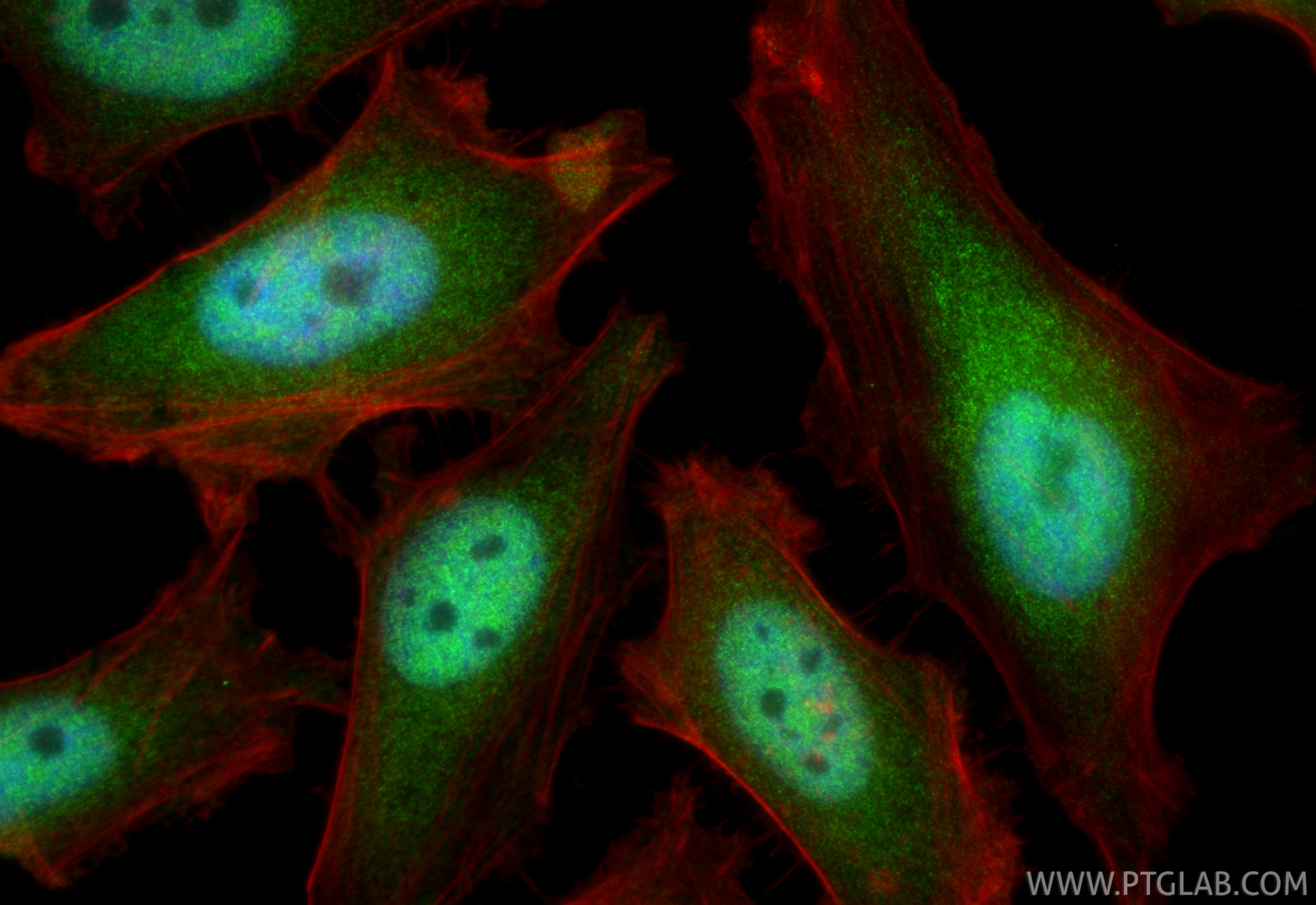 IF Staining of HeLa using 85332-2-RR
