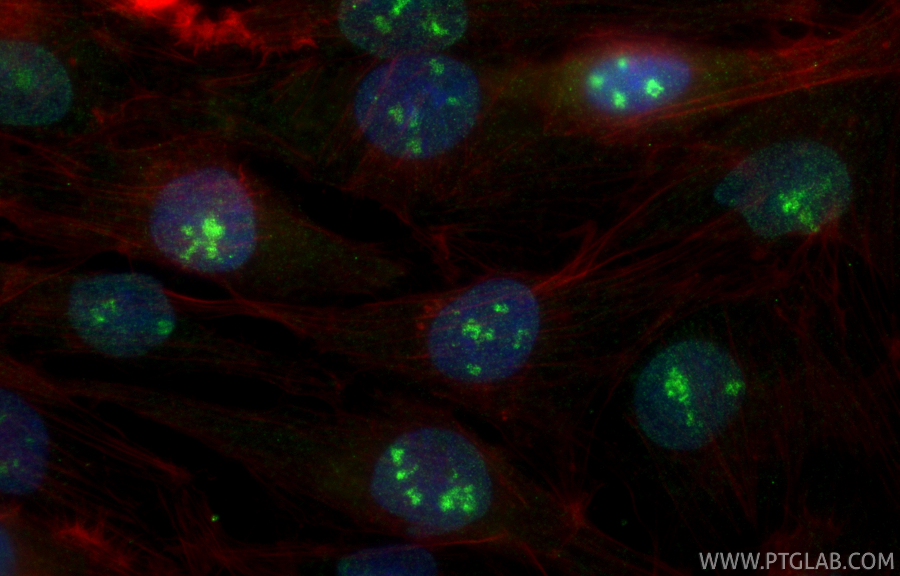 IF Staining of ROS1728 using 32161-1-AP (same clone as 32161-1-PBS) IF Staining of ROS1728 using 32161-1-AP (same clone as 32161-1-PBS)