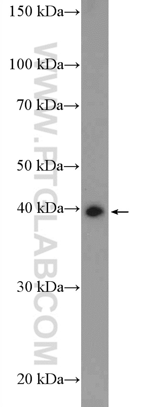 WB analysis of mouse testis using 11564-1-AP