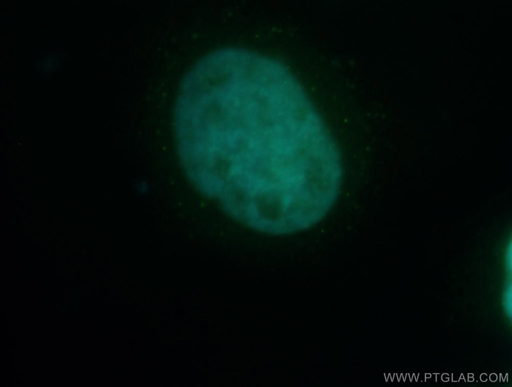 IF Staining of HeLa using 12099-1-AP
