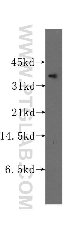 WB analysis of K-562 using 12099-1-AP