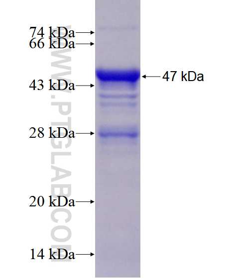 UBN1 fusion protein Ag28501 SDS-PAGE UBN1 fusion protein Ag28501 SDS-PAGE