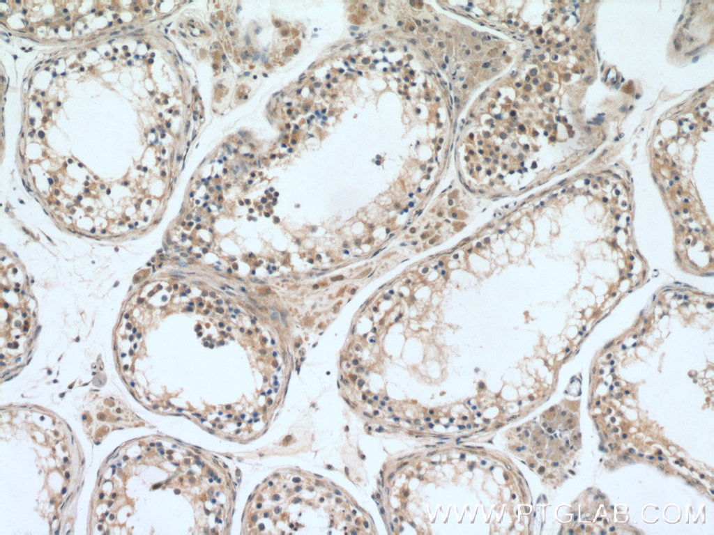 IHC staining of human testis using 23449-1-AP