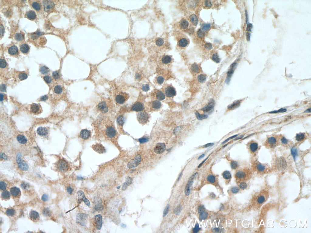 IHC staining of human testis using 23449-1-AP