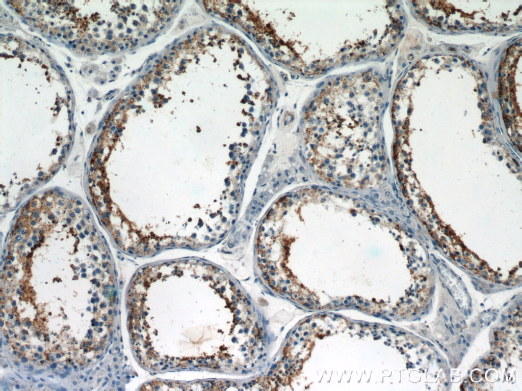 IHC staining of human testis using 23372-1-AP