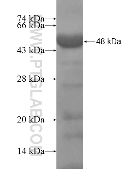 Ubiquilin 3 fusion protein Ag19988 SDS-PAGE Ubiquilin 3 fusion protein Ag19988 SDS-PAGE
