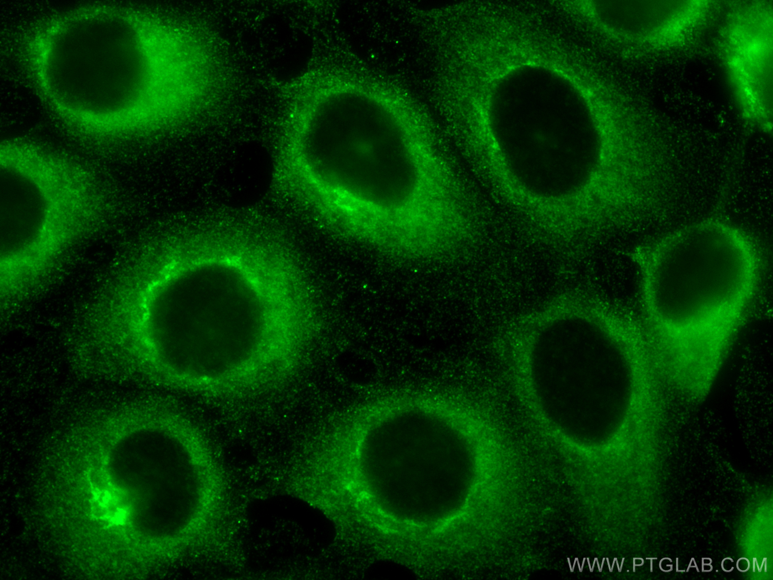 IF Staining of A431 using 16400-1-AP